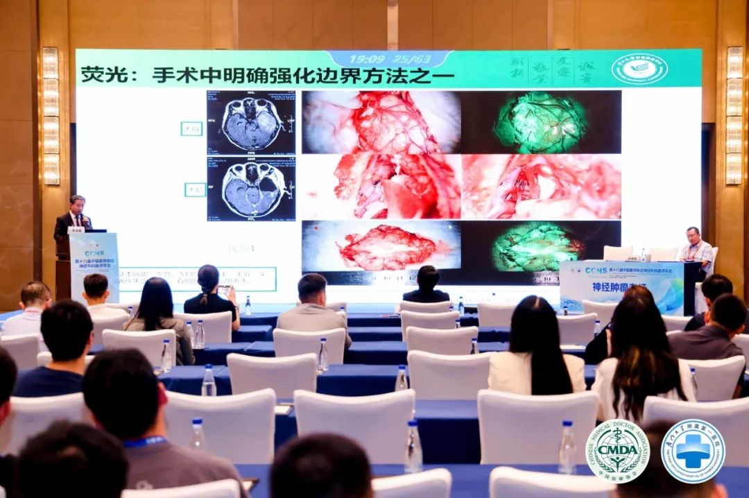 腦膠質(zhì)瘤治療新曙光：EndoSCell?細胞級精準手術方案亮相2024CCNS(圖4)